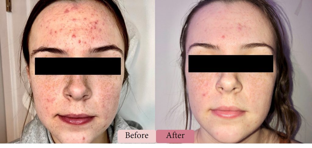 Divine Pro-New - DermaSpark Products Inc.