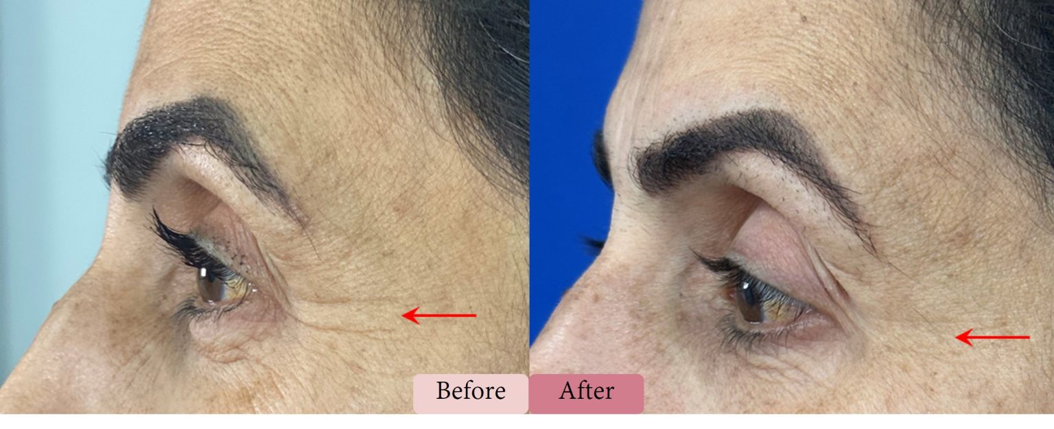 Divine Pro - DermaSpark Products Inc.