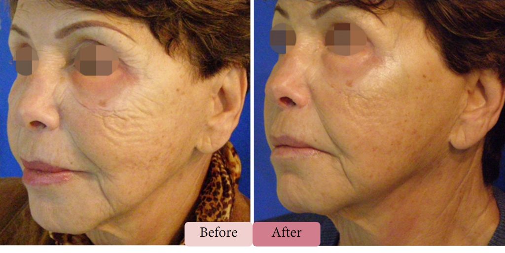 Divine Pro-New - DermaSpark Products Inc.