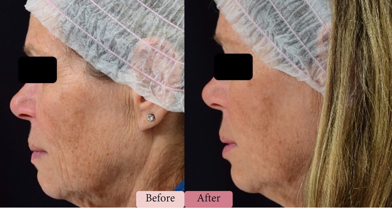 Divine Pro-New - DermaSpark Products Inc.