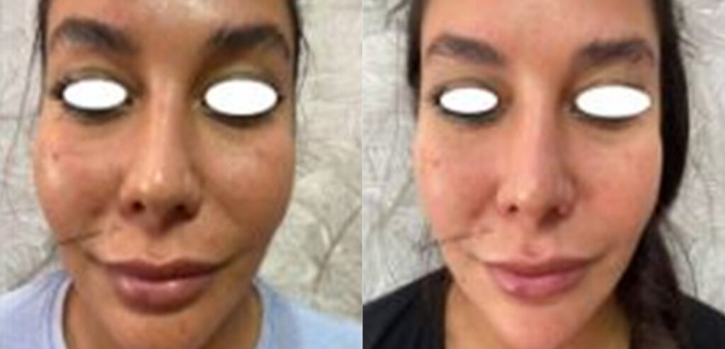 My Skin Chemistry (BIOREG)
