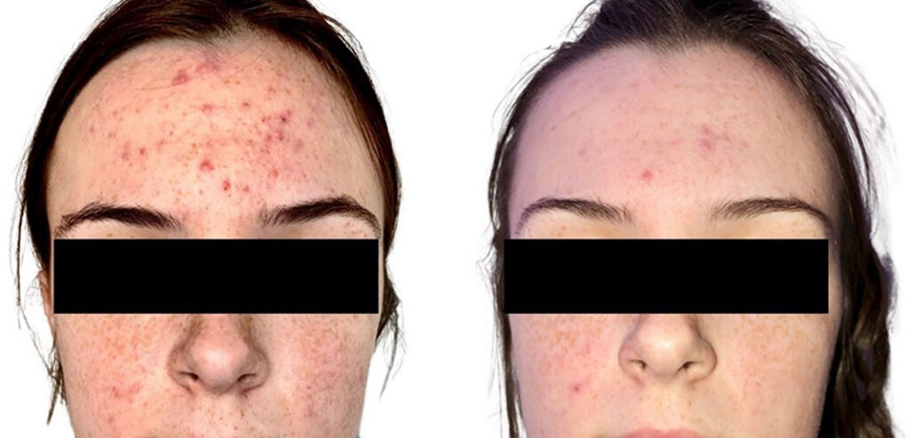 Divine Pro — Non-Surgical Facelift