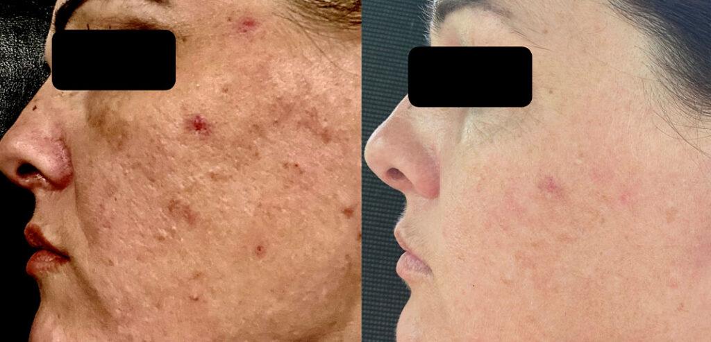 Divine Pro — Non-Surgical Facelift