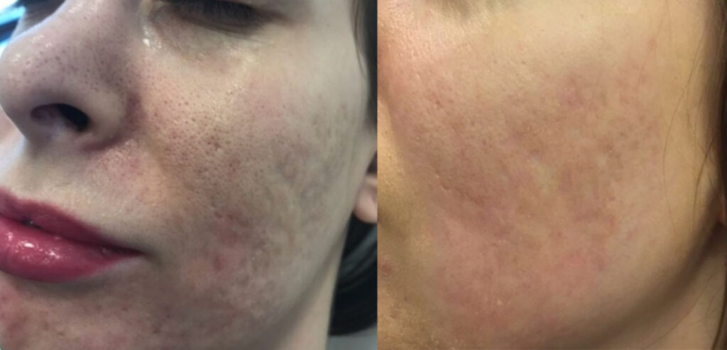 Divine Pro — Non-Surgical Facelift