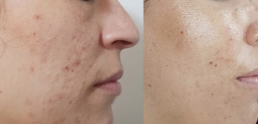 Noon Aesthetics Skincare