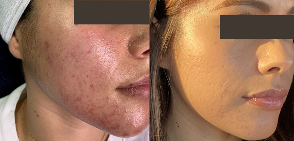 Noon Aesthetics Skincare