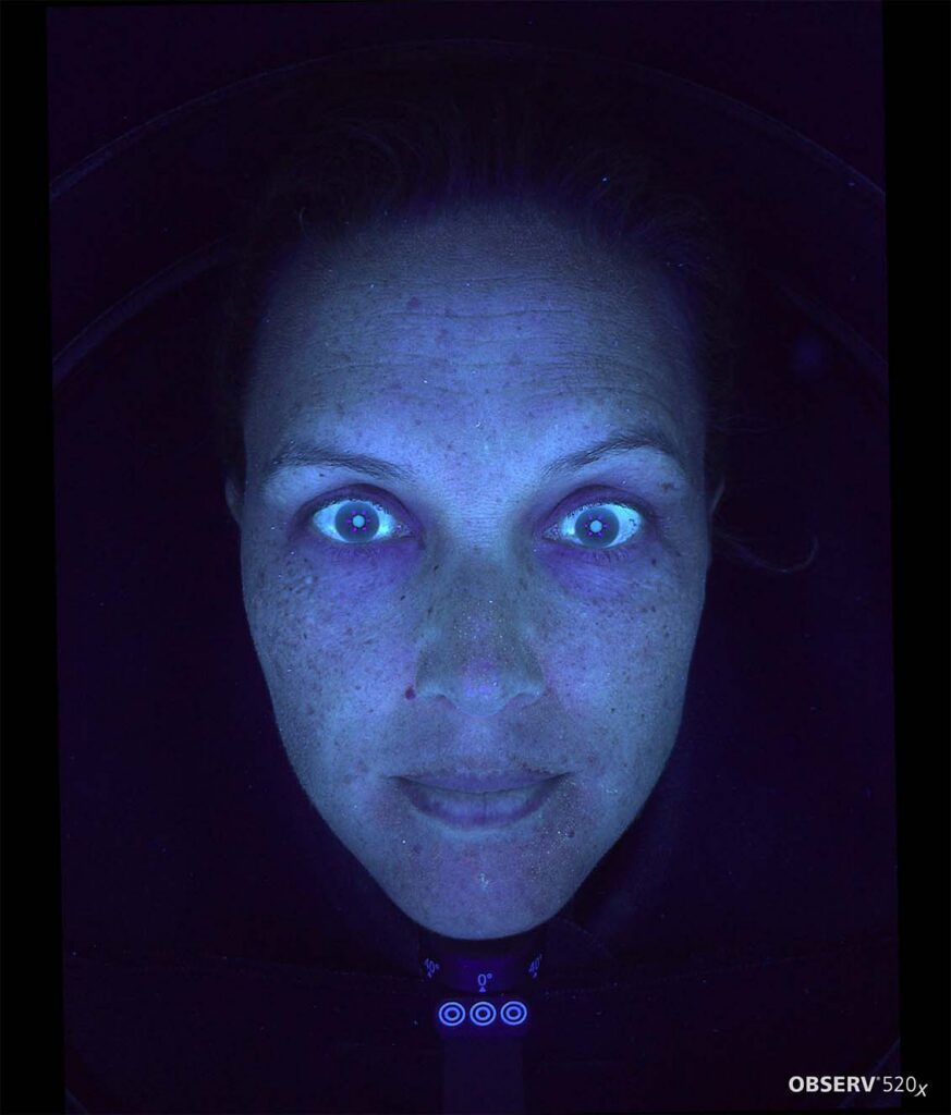 OBSERV — Professional Skin Analysis