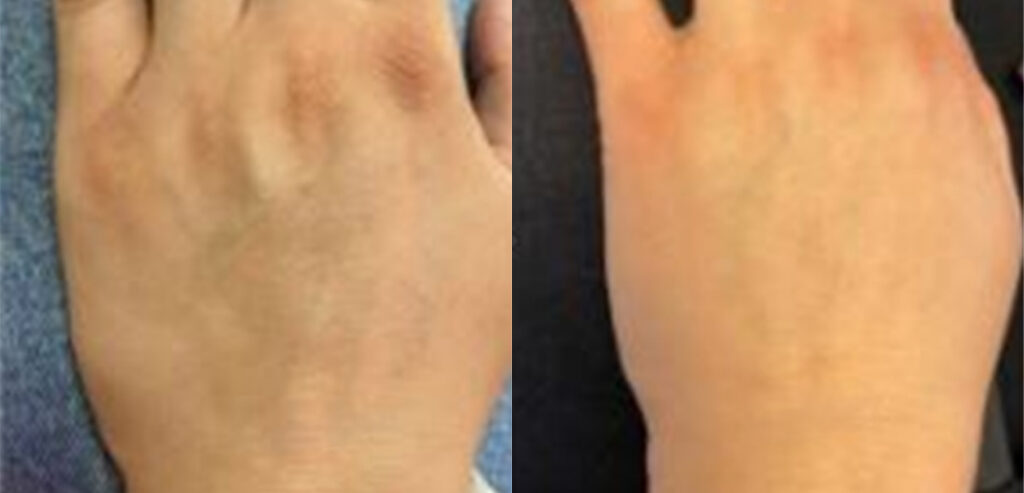 My Skin Chemistry (BIOREG)