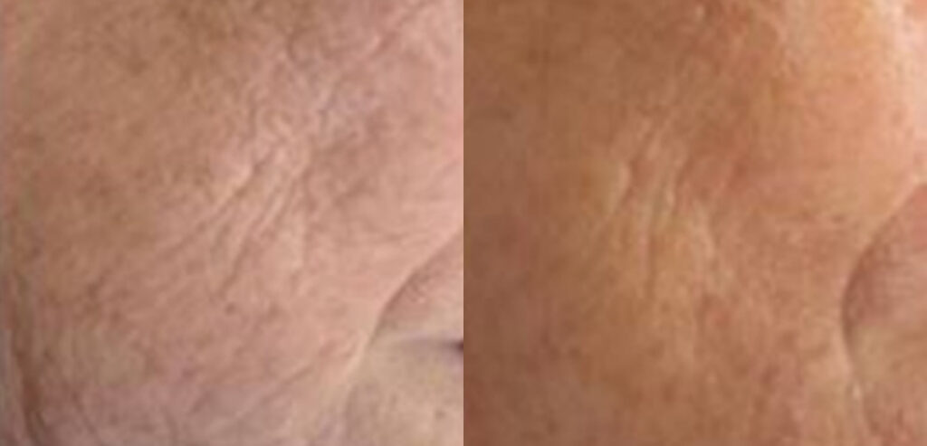 My Skin Chemistry (BIOREG)