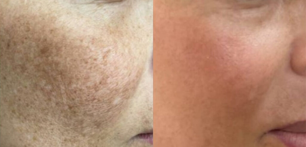 My Skin Chemistry (BIOREG)