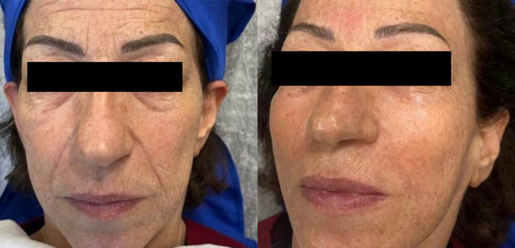 My Skin Chemistry (BIOREG)