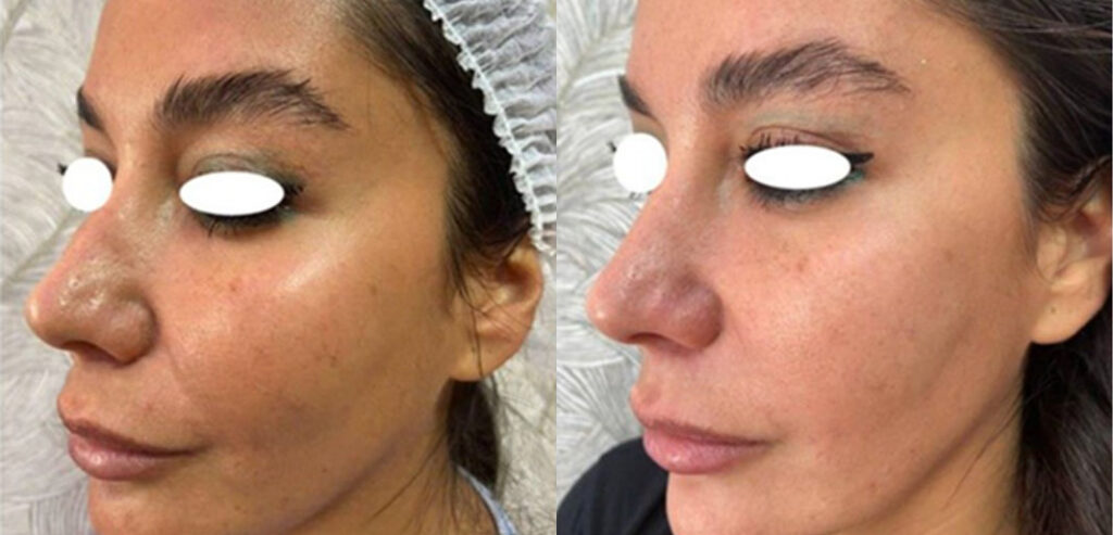 My Skin Chemistry (BIOREG)