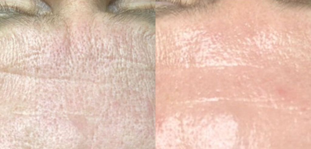 Noon Aesthetics Skincare