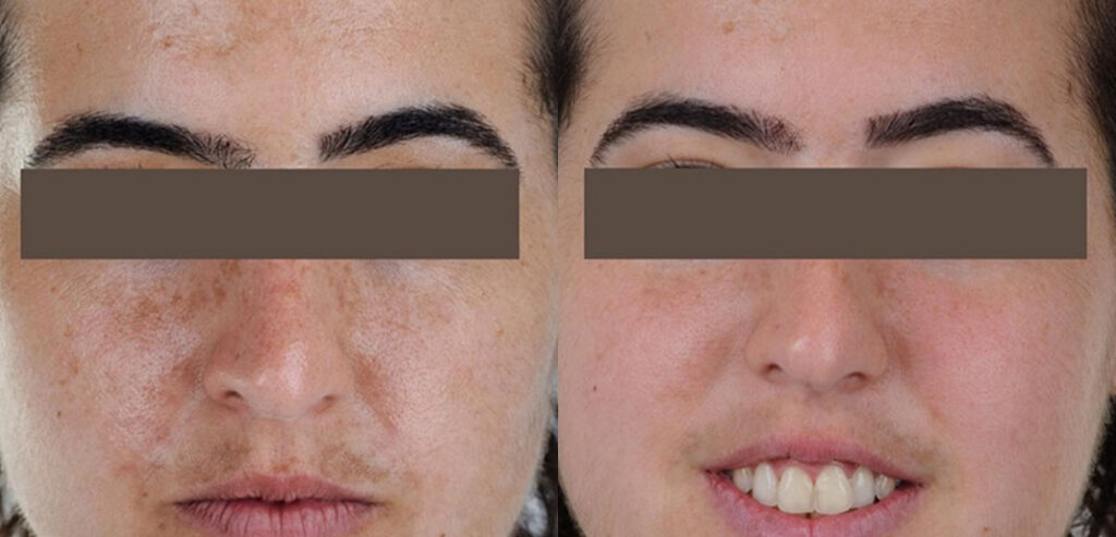 Noon Aesthetics Skincare