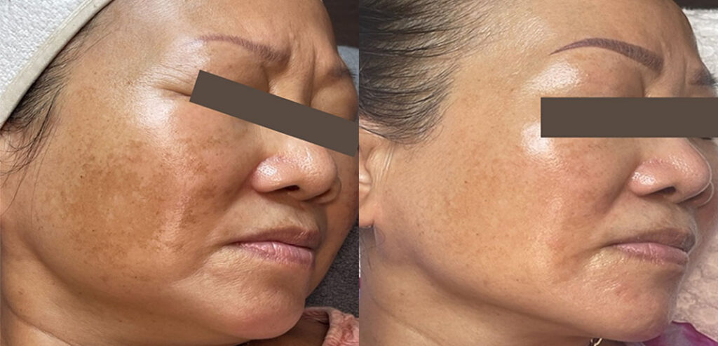 Noon Aesthetics Skincare