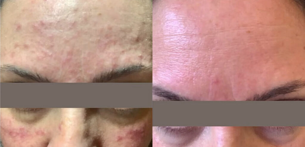 Noon Aesthetics Skincare